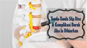Rawatan slip disc tanpa pembedahan. Tanda Tanda Slip Disc Komplikasi Buruk Jika Dibiarkan Ohcantik Com