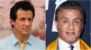 Gubitak kose: Slavni muškarci koji su presadili kosu