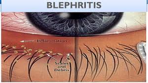 Image result for Blepharis sol