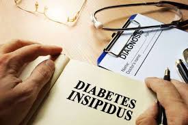 Penyebab utama diabetes adalah gaya hidup yang tidak sehat seperti konsumsi makanan yang manis dan berlemak secara berlebihan. Diabetes Insipidus Penyebab Diagnosis Gejala Doctoroncall