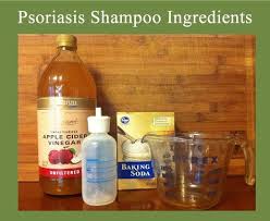Homemade Natural Psoriasis Shampoo Psoriasis Shampoo Shampoo Ingredients Natural Psoriasis Remedies