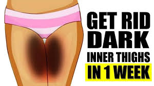 How To Get Rid Of Dark Inner Thighs In A Week Lighten Dark Inner Thigh Dark Spots On Skin Skin Spots Lighten Skin