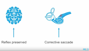 Image result for HiNTs Exam