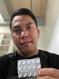 3Days Allergies Attack at my face,Shanget na nga mas pina Shanget pa