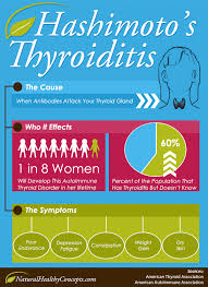 Hashimoto S Thyroiditis Apom