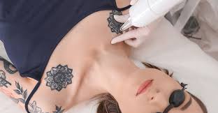 So that is a good benefit of microblading! Laser Tattoo Removal Austin Tx Tattoo Removal Austin Tx