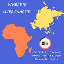A large percentage of these tumors occur in children who are born premature. The Link Between Hepatitis B And Liver Cancer Hepatitis B Foundation