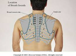 Lung Landmarks For Auscultation Posterior Fields Health Assessment Nursing Nursing School Survival Lung Sounds