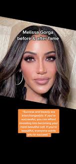 Melissa Gorga Nose Before and After