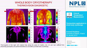Cryotherapy can be used to treat a variety of skin conditions and some cancers, including prostate and liver cancer. Cryotherapy A Wordpress Site