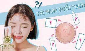 10 kem trị mụn cho tuổi dậy thì hiệu quả tốt nhất cho da