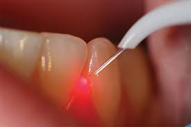 Apex dentist are conveniently located right in for the best dental care in aukcland, you can always count on apex dental. Dental Treatments Abroad Dental Clinic Heraklion Crete