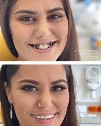 Katrina Bentley's Instagram, Twitter & Facebook