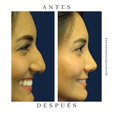 Dr. Mario Botero Ramirez (@marioboteroramirez) • Instagram photos and videos