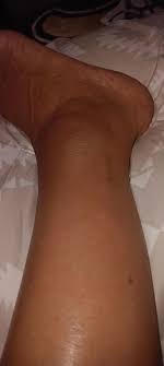 I just missed a step coming downstairs...