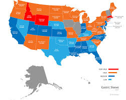 Gastric Sleeve Price Map Obesity Coverage
