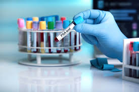 İşte detaylar… pcr testi nasıl yapılır? Pcr Testi Nedir Nasil Yapilir Memorial