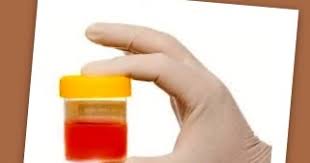 Jangan tidak mempedulikan darah dalam kekerapan saya untuk kencing pada setiap hari juga turut meningkat. 5 Punca Masalah Kencing Berdarah Dmanje Spa Bangi