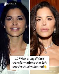 10 “Mar-a-Lago” Face Transformations That Left People Utterly Stunned (link  in the comments)