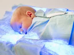 Who were the newborns with whom we need to go that extra step, and measure the bilirubin in the blood? Physiologic Jaundice In Babies