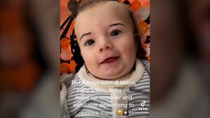 Six Month Old Baby Left Looking Like Addams Family Member Week After Fancy Dress Party Lifestyle Independent Tv