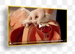 When my own father collapsed a few years ago from a cardiac arrest, one of the first volunteers to arrive to save my father was one of these muslim. Cardiac Arrest Images Cardiac Arrest Transparent Png Free Download
