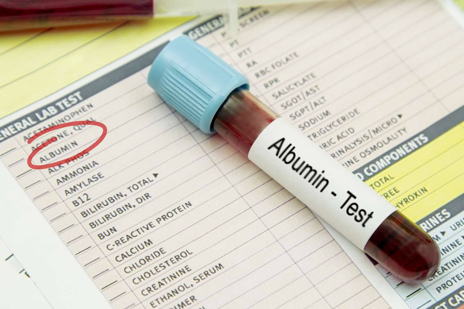 ALBUMIN product image