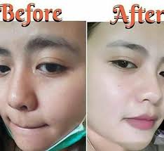 Dapatkan Kulit Wajah Glowing Dalam Waktu Satu Minggu Ada Harga Ada Kualitas Manfaat Menghilangkan F Beauty Shop Instagram Posts Powerful Quotes