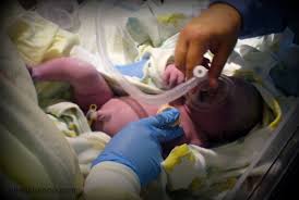 Does she have Down syndrome?