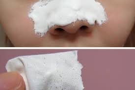 3 Prirodne Pletove Masky Ktore Vas Zbavia Ciernych Bodiek Beauty Beauty Care Beauty Recipe