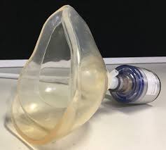 Diving and Hyperbaric Medicine