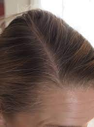 Feststecken, um es zu untersuchen. Update Graue Haare Silbershampoo Und So Weiter Irit Eser