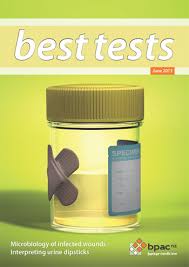 Blood in urine, also called hematuria, is a serious symptom you should investigate immediately. Interpreting Urine Dipstick Tests In Adults Best Tests Issue 19