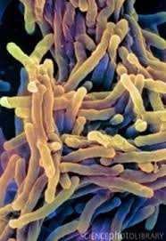 Pin By Marcia Neimeyer On Biology Bytes Microscopic Photography Scanning Electron Microscope Electron Microscope