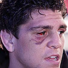 Breaking News: Diaz Tests Positive for Marijuana