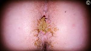 SCATBOOK 💩 (@SCATBOOKSOCIAL)  X