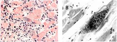 H hérba, hábitus, hépar, húmerus, hemiplegía, hyoídeus, histológia, hómo, hirúdo, hygiéna, hérpes, inhalátor, hydrocyánicus. Chagas En La Argentina Indicadores De Pronostico Introduccion