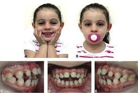 Pin On Pediatric Dental Victoria Tx