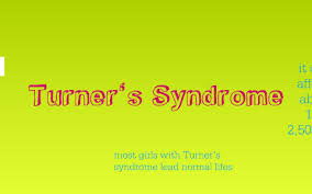 Turners Syndrome By Tayler Nordhausen On Prezi