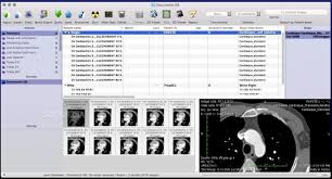 More than a dicom viewer, athena dicom essential marks a new generation of software to view and manipulate medical images. Top 15 Free Dicom Viewers