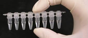 The Journey Of The Covid 19 Swab From Nostril To Lab Result New Zealand Doctor