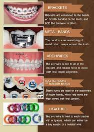 Braces Dental Braces Braces Tips Getting Braces
