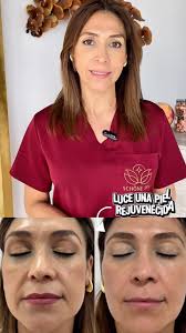 ✨ ¡Transforma tu piel con el tratamiento HIFU 12D de Schöne Spa! ✨,  ¿Cansada de las líneas de expresión y la flacidez? Nuestro tratamiento de  vanguardia HIFU 12D te ofrece un #LiftingSinCirugía con ...