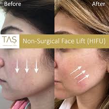 Booking system was easy too, they seem quite. Tas Baby Skin Care Assoc Prof Dr Suleyman Tas