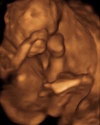 Image result for tbn:T5UajvfpShvp6M::www.photoslinks.com/index.php%3Foption%3Dcom_joomgallery%26func%3Dwatermark%26catid%3D4%26id%3D23%26Itemid%3D2