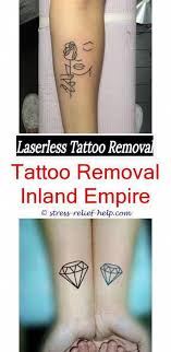 We were the first clinic in lexington, ky to provide this state of the art technology to our patients. Did Chris Brown Removes Karrueche Tattoo At Home Tattoo Removal That Works Laser Tattoo Removal Sydney Ta At Home Tattoo Removal Diy Tattoo Permanent Tattoos