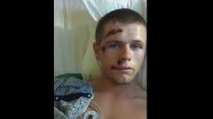 Crawford County family needs car after assault