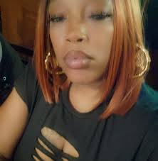 Sonny and Carly's daughter, Donna, was born with spina bifida. Where did  that go? There was never any surgery or anything like that. I guess they  just made it disappear.