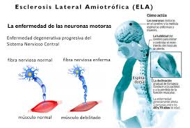 Por ejemplo, en ezra 5:1 ela yisrael significa dios de israel. 75 Ela ã•ã‹ãªãªã¿