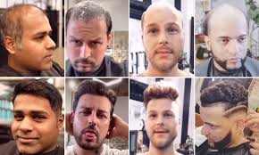 How to choose right mens hair salon dapper divine. Hairdresser Goes Viral With Videos Showing Bald Men Transformed By Non Surgical Hair Replacements Daily Mail Online